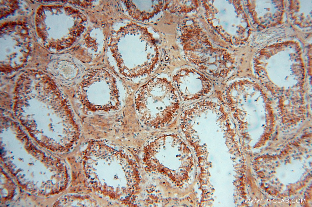 Immunohistochemistry (IHC) staining of human testis tissue using PDIR Polyclonal antibody (15545-1-AP)