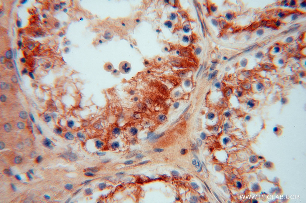 Immunohistochemistry (IHC) staining of human testis tissue using PDIR Polyclonal antibody (15545-1-AP)