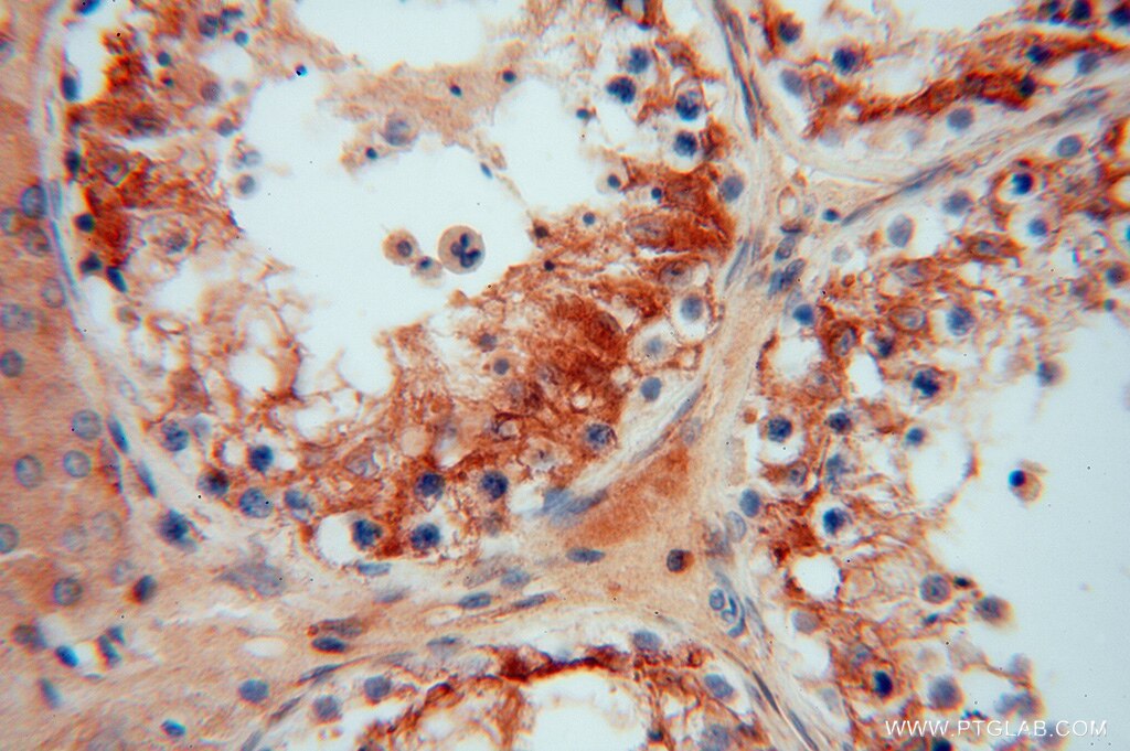 IHC staining of human testis using 15545-1-AP