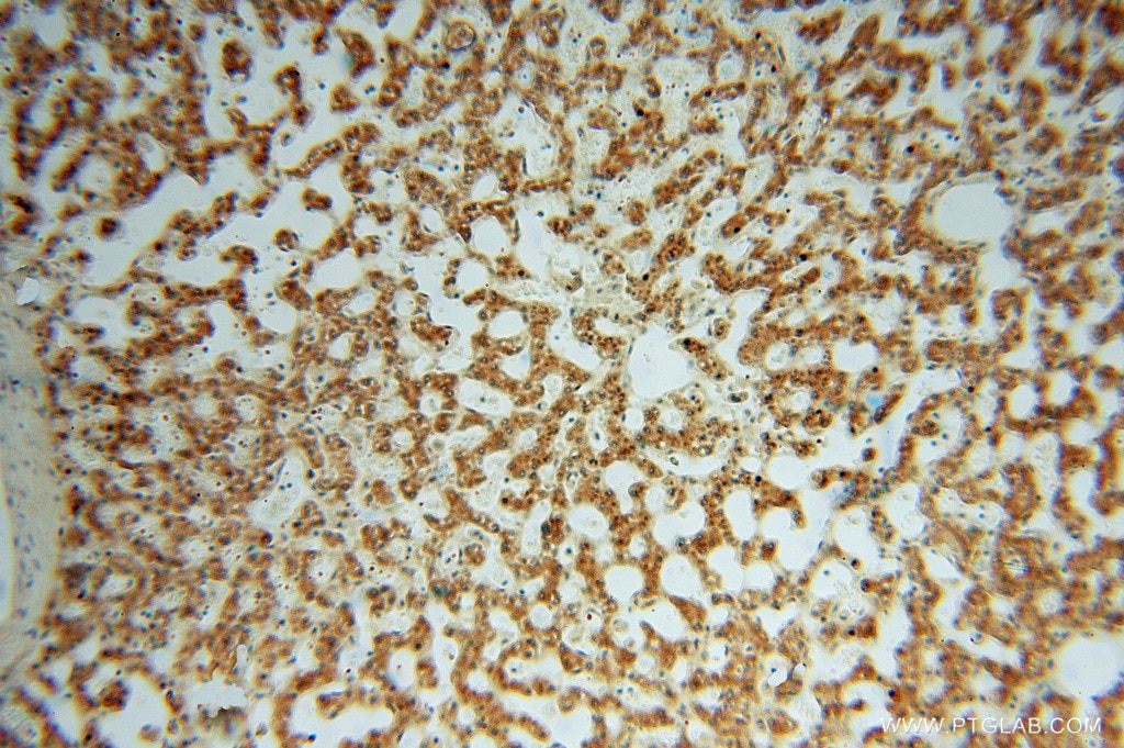 Immunohistochemistry (IHC) staining of human liver tissue using PDIR Polyclonal antibody (15545-1-AP)