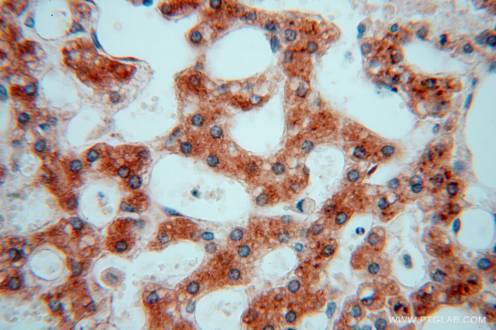 Immunohistochemistry (IHC) staining of human liver tissue using PDIR Polyclonal antibody (15545-1-AP)