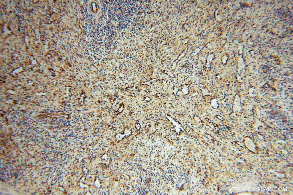 Immunohistochemistry (IHC) staining of human spleen tissue using PDIR Polyclonal antibody (15545-1-AP)