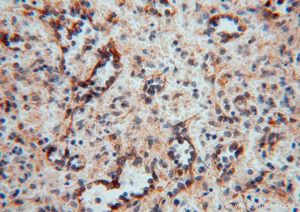 Immunohistochemistry (IHC) staining of human spleen tissue using PDIR Polyclonal antibody (15545-1-AP)
