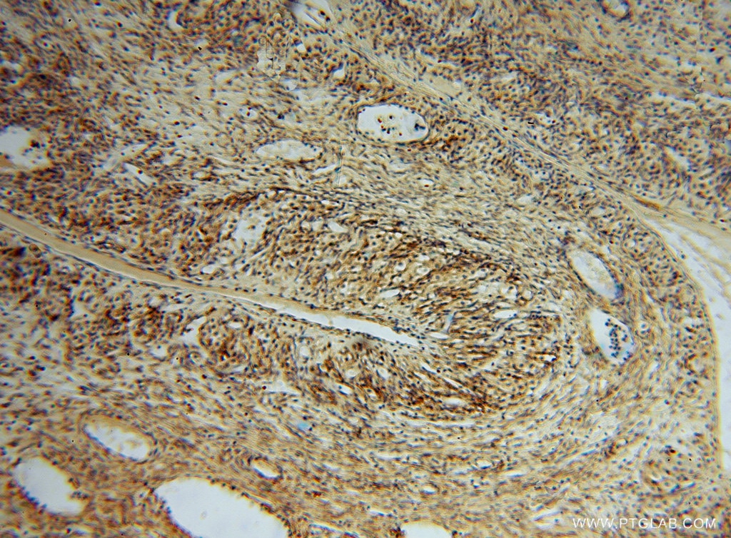 Immunohistochemistry (IHC) staining of human ovary tissue using PDIR Polyclonal antibody (15545-1-AP)