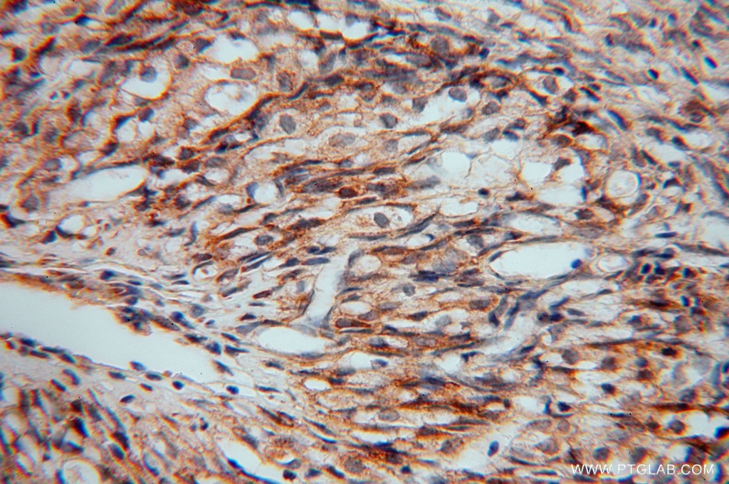 Immunohistochemistry (IHC) staining of human ovary tissue using PDIR Polyclonal antibody (15545-1-AP)