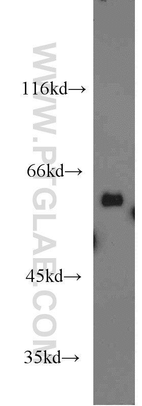 Western Blot (WB) analysis of mouse liver tissue using PDIR Polyclonal antibody (15545-1-AP)