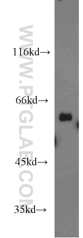 Western Blot (WB) analysis of mouse liver tissue using PDIR Polyclonal antibody (15545-1-AP)