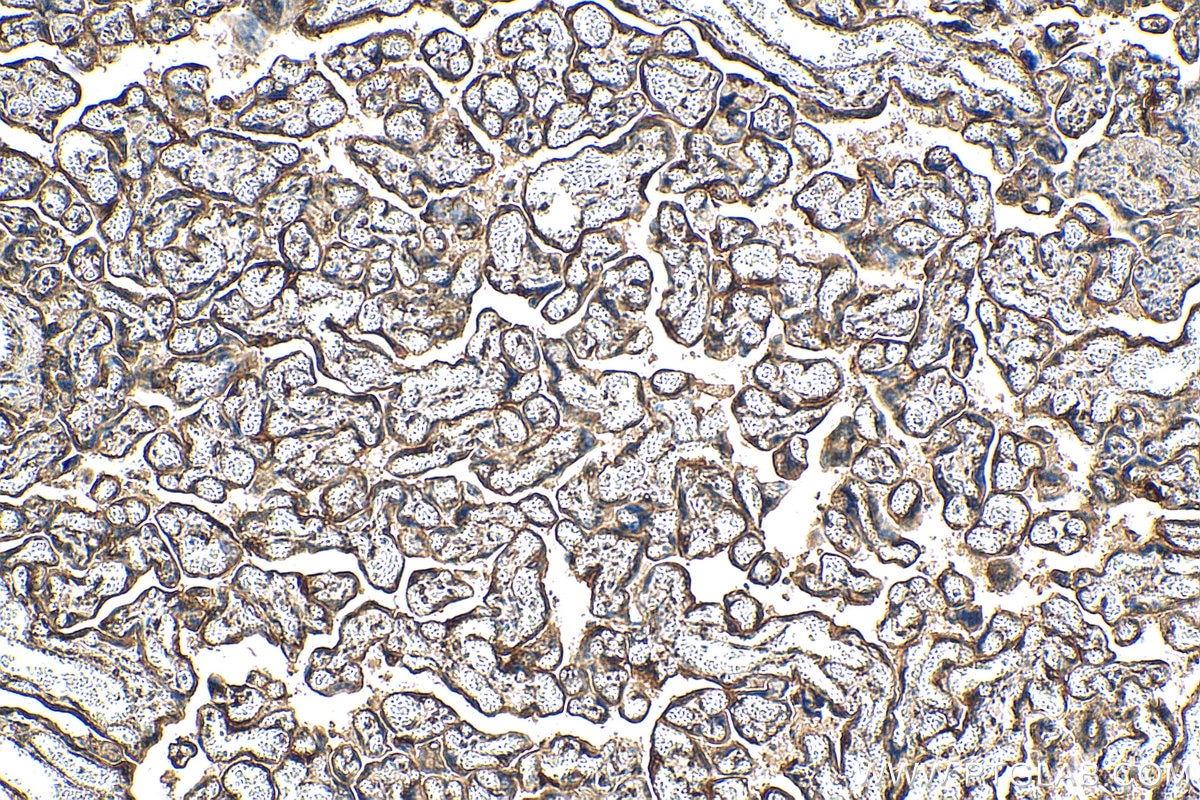 Immunohistochemistry (IHC) staining of human placenta tissue using PDIR Polyclonal antibody (29593-1-AP)