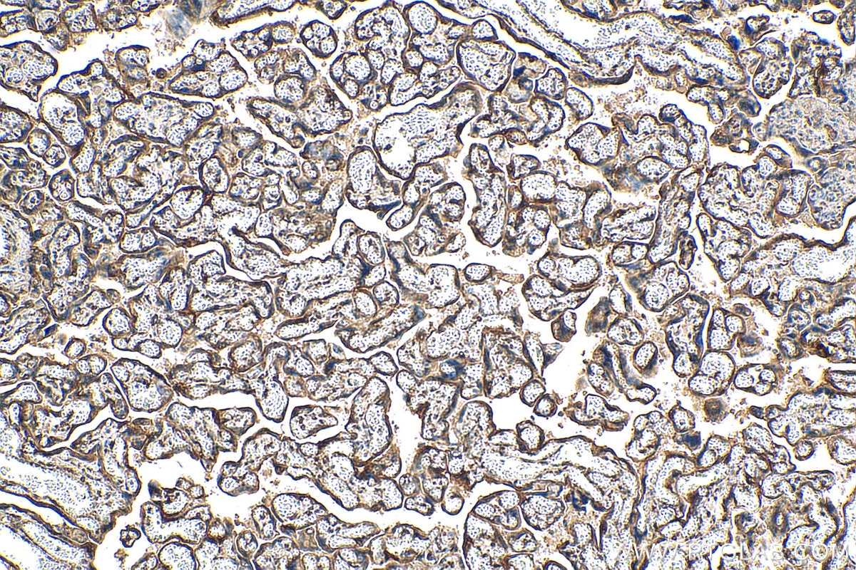 IHC staining of human placenta using 29593-1-AP