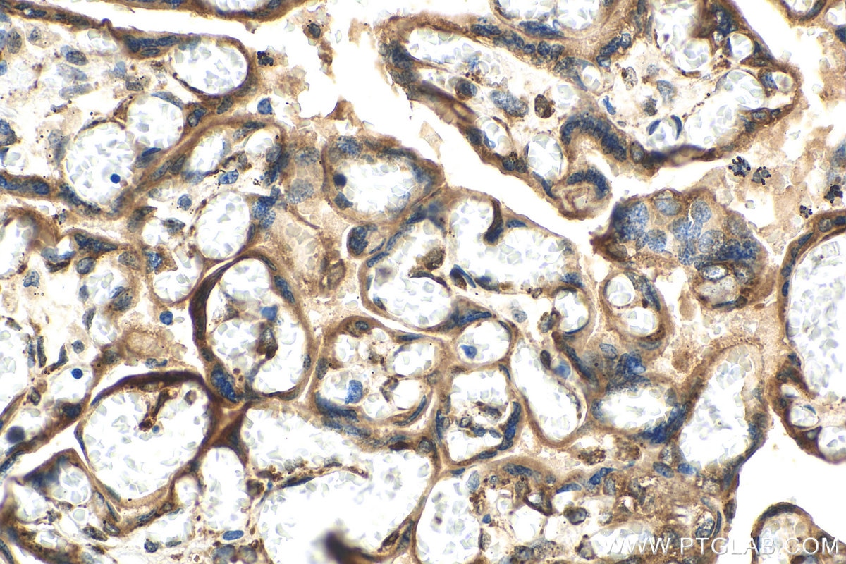 IHC staining of human placenta using 29593-1-AP