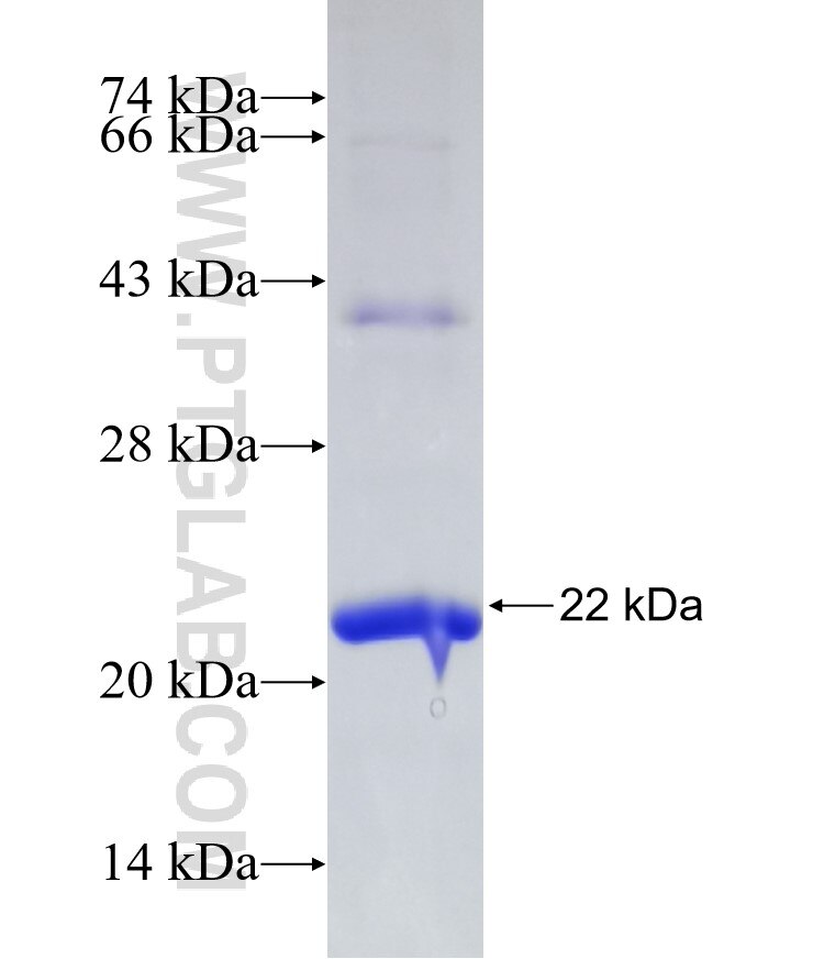 PDIA5 fusion protein Ag31493 SDS-PAGE PDIA5 fusion protein Ag31493 SDS-PAGE
