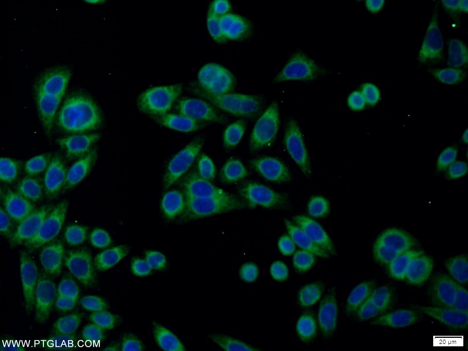 IF Staining of HeLa using 18233-1-AP