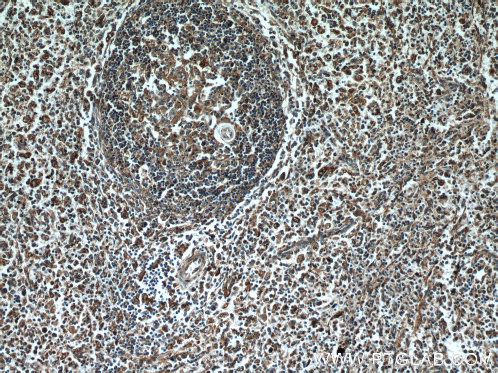 Immunohistochemistry (IHC) staining of human spleen tissue using PDIA6 Polyclonal antibody (18233-1-AP)