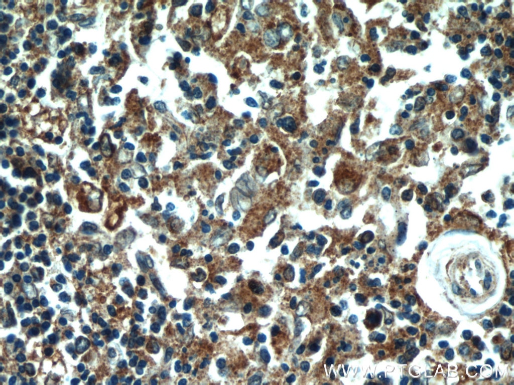 Immunohistochemistry (IHC) staining of human spleen tissue using PDIA6 Polyclonal antibody (18233-1-AP)