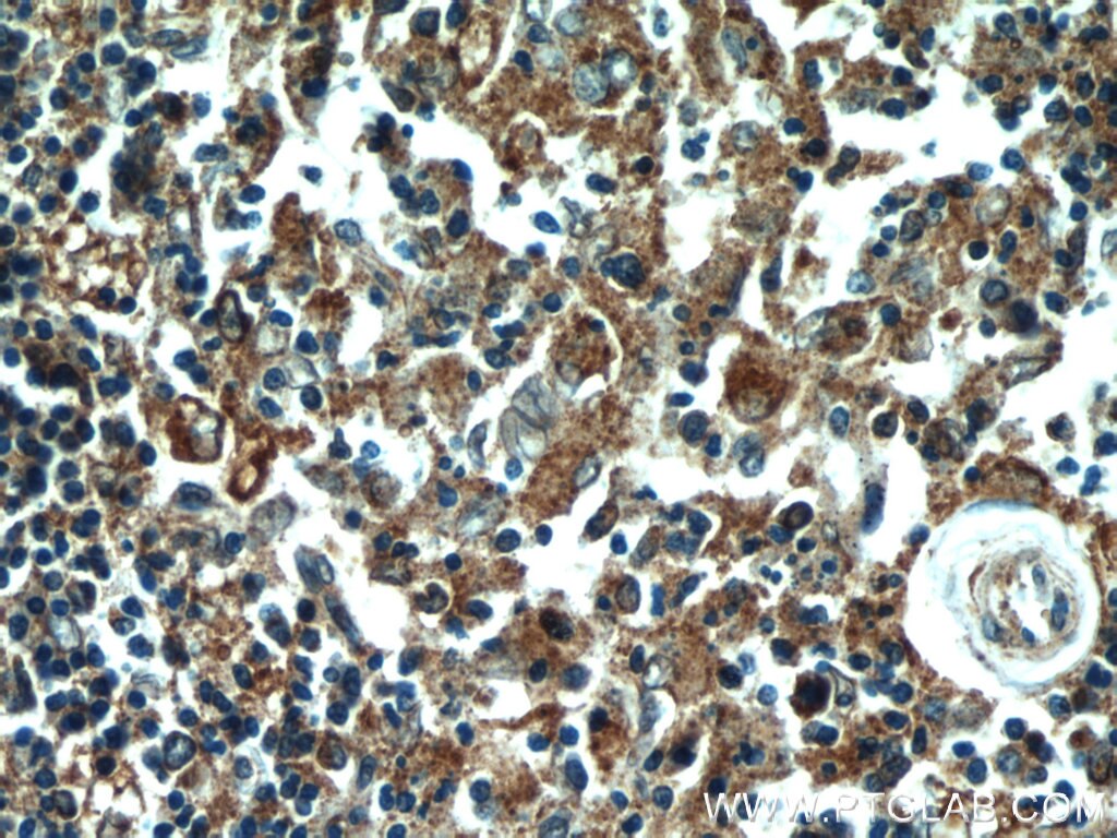 IHC staining of human spleen using 18233-1-AP