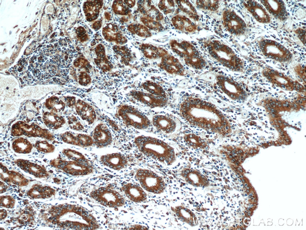Immunohistochemistry (IHC) staining of human stomach tissue using PDIA6 Polyclonal antibody (18233-1-AP)