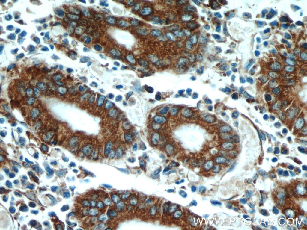 Immunohistochemistry (IHC) staining of human stomach tissue using PDIA6 Polyclonal antibody (18233-1-AP)
