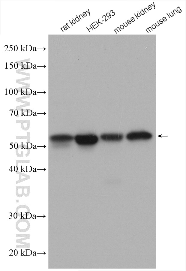 Western Blot (WB) analysis of various lysates using PDIA6 Polyclonal antibody (18233-1-AP)
