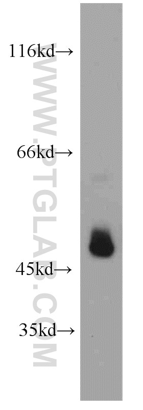 Western Blot (WB) analysis of mouse kidney tissue using PDIA6 Polyclonal antibody (18233-1-AP)