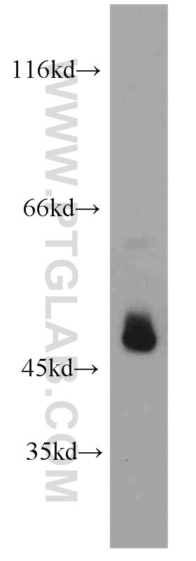 WB analysis of mouse kidney using 18233-1-AP