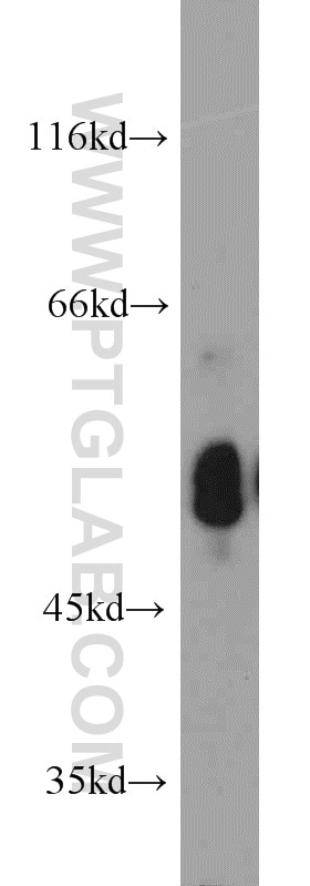 Western Blot (WB) analysis of mouse lung tissue using PDIA6 Polyclonal antibody (18233-1-AP)