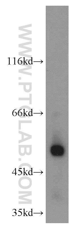 Western Blot (WB) analysis of mouse liver tissue using PDIA6 Polyclonal antibody (18233-1-AP)