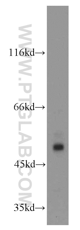 Western Blot (WB) analysis of mouse lung tissue using PDIA6 Polyclonal antibody (18233-1-AP)