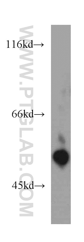 Western Blot (WB) analysis of HeLa cells using PDIA6 Polyclonal antibody (18233-1-AP)