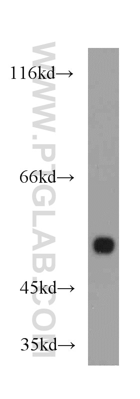 WB analysis of mouse kidney using 18233-1-AP