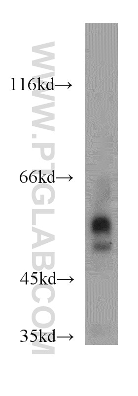 Western Blot (WB) analysis of mouse heart tissue using PDIA6 Polyclonal antibody (18233-1-AP)