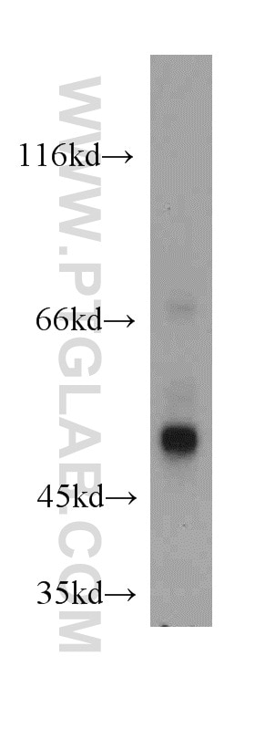 Western Blot (WB) analysis of HeLa cells using PDIA6 Polyclonal antibody (18233-1-AP)