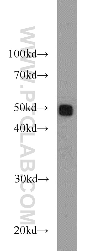 Western Blot (WB) analysis of HEK-293 cells using PDIA6 Polyclonal antibody (18233-1-AP)