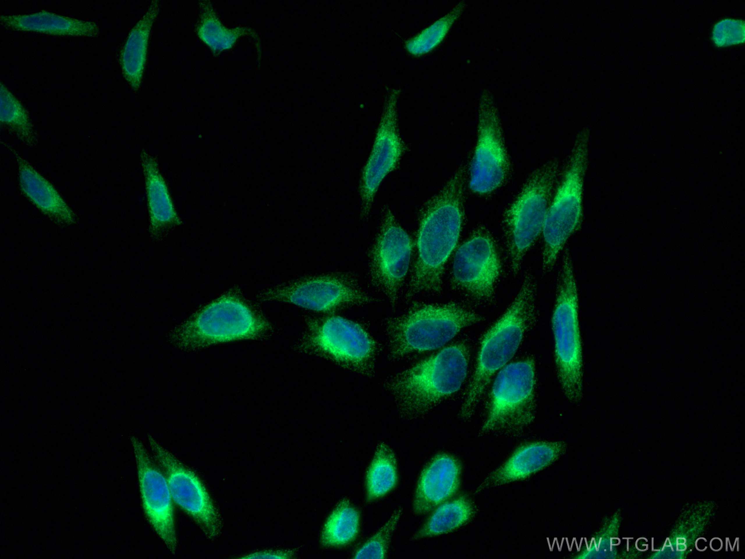 Immunofluorescence (IF) / fluorescent staining of HepG2 cells using PDIA6 Monoclonal antibody (66669-1-Ig)