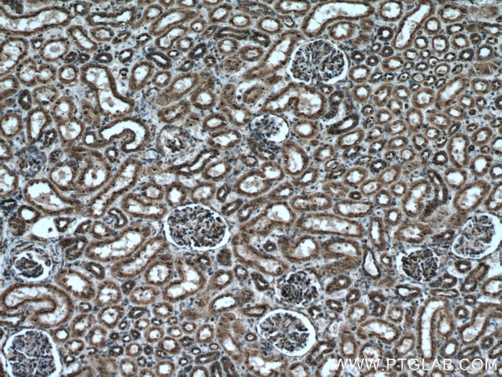 Immunohistochemistry (IHC) staining of human kidney tissue using PDIA6 Monoclonal antibody (66669-1-Ig)