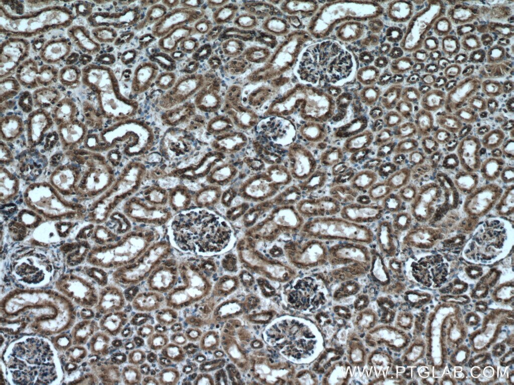 IHC staining of human kidney using 66669-1-Ig