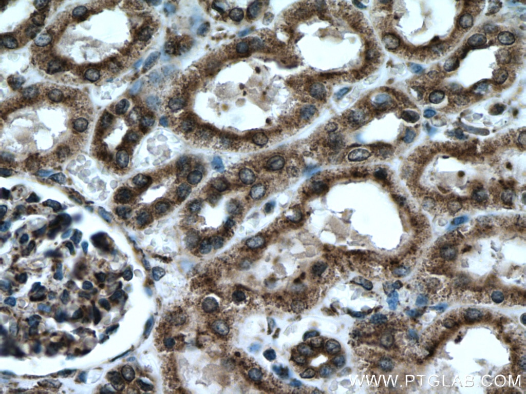 Immunohistochemistry (IHC) staining of human kidney tissue using PDIA6 Monoclonal antibody (66669-1-Ig)