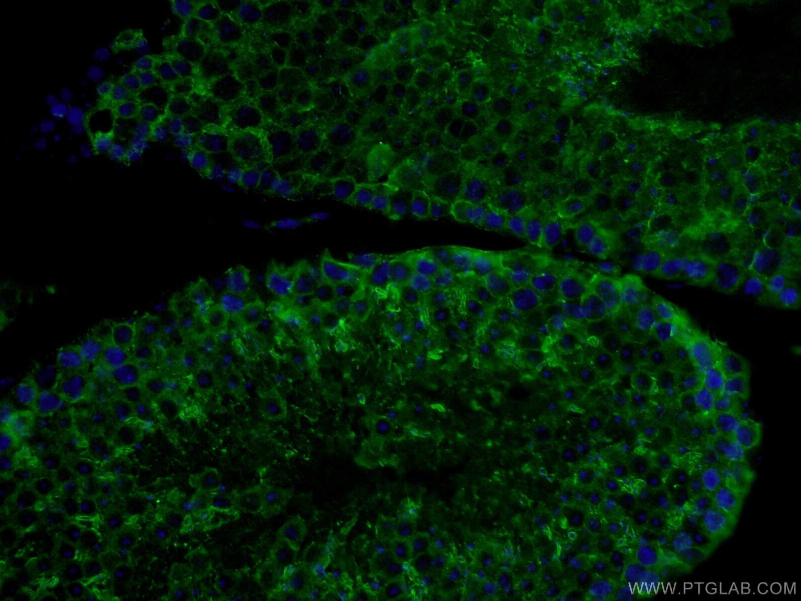 Immunofluorescence (IF) / fluorescent staining of mouse testis tissue using PDILT Polyclonal antibody (26305-1-AP)