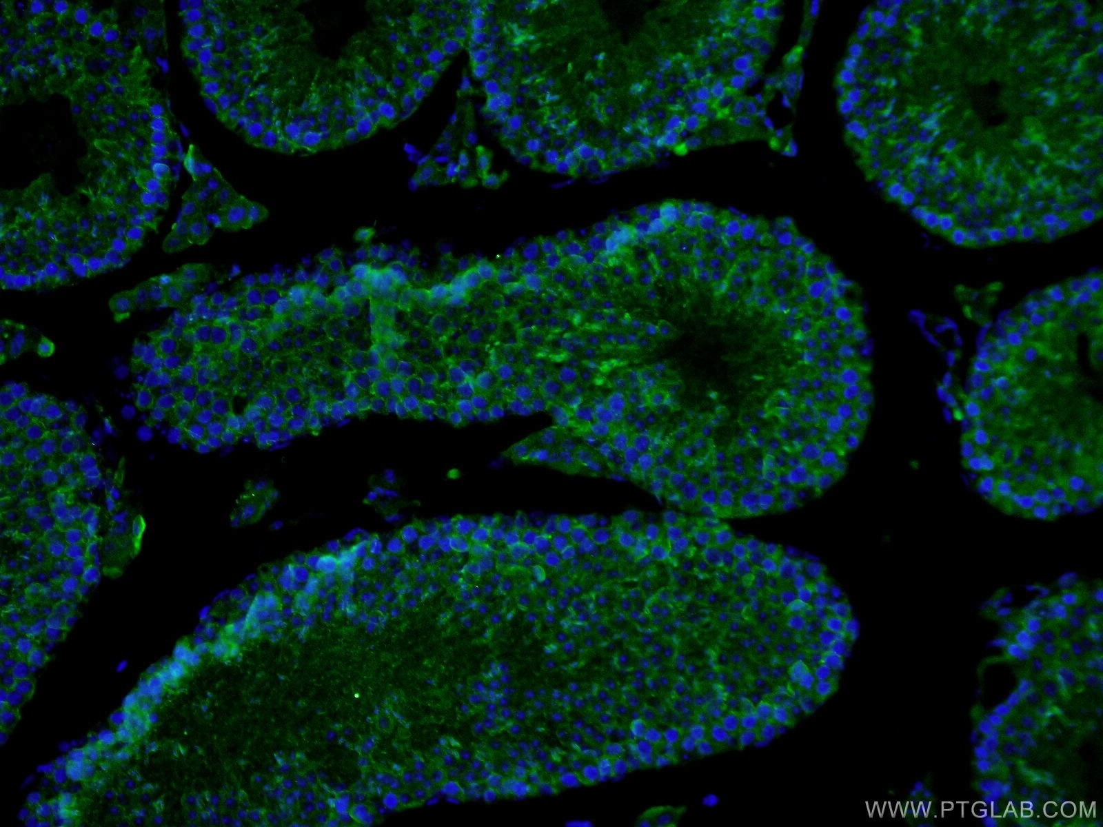 Immunofluorescence (IF) / fluorescent staining of mouse testis tissue using PDILT Polyclonal antibody (26305-1-AP)