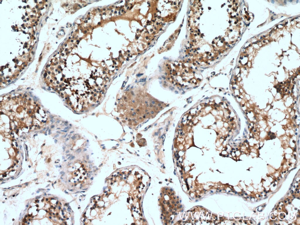 Immunohistochemistry (IHC) staining of human testis tissue using PDILT Polyclonal antibody (26305-1-AP)