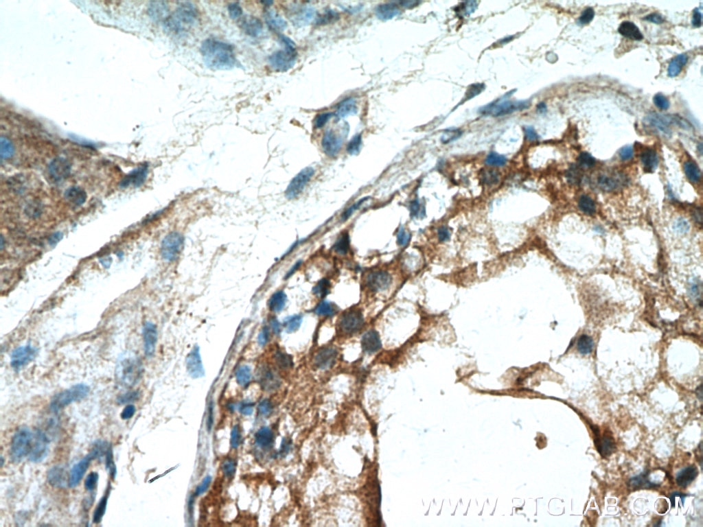 Immunohistochemistry (IHC) staining of human testis tissue using PDILT Polyclonal antibody (26305-1-AP)