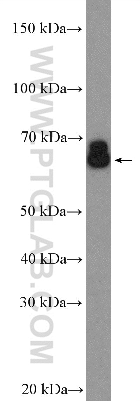 Western Blot (WB) analysis of mouse testis tissue using PDILT Polyclonal antibody (26305-1-AP)