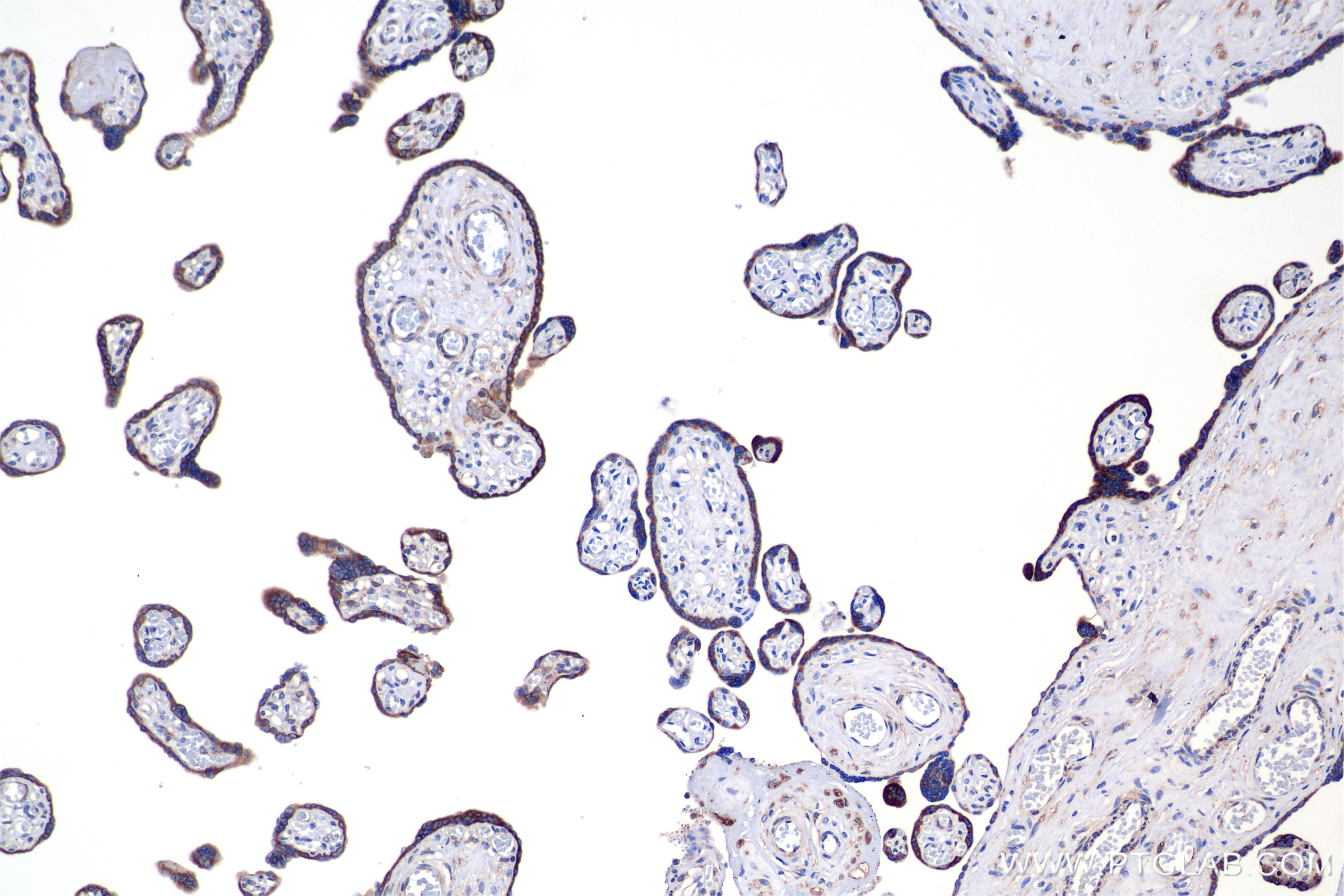 Immunohistochemical analysis of paraffin-embedded human placenta tissue slide using 85599-4-RR (PDIR antibody) at dilution of 1:4000 (under 10x lens). Heat mediated antigen retrieval with Tris-EDTA buffer (pH 9.0). Immunohistochemistry (IHC) staining of human placenta tissue using PDIR Recombinant monoclonal antibody (85599-4-RR)