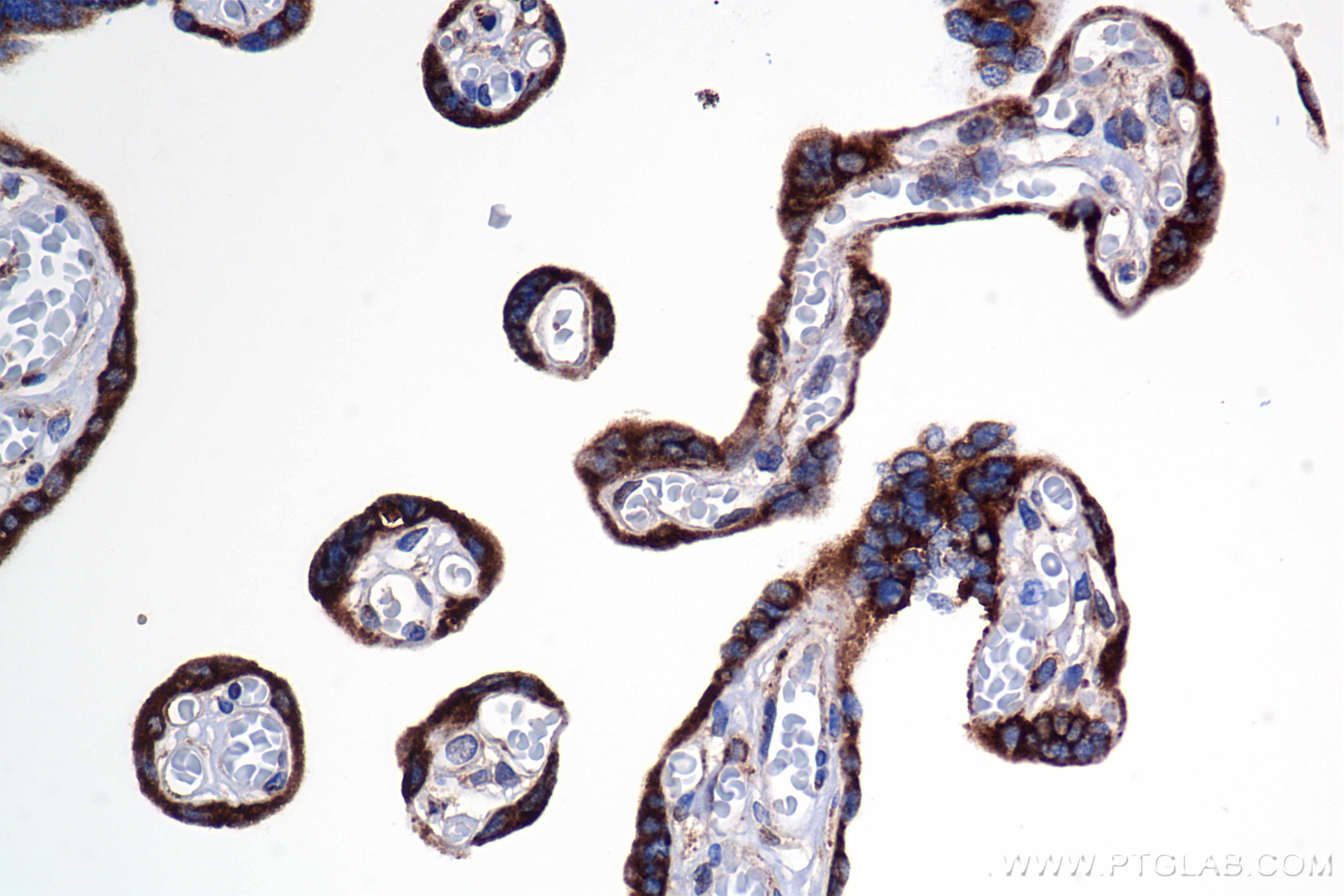 Immunohistochemical analysis of paraffin-embedded human placenta tissue slide using 85599-4-RR (PDIR antibody) at dilution of 1:4000 (under 40x lens). Heat mediated antigen retrieval with Tris-EDTA buffer (pH 9.0). Immunohistochemistry (IHC) staining of human placenta tissue using PDIR Recombinant monoclonal antibody (85599-4-RR)