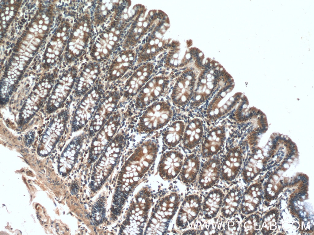 Immunohistochemistry (IHC) staining of human colon tissue using PDK1 Polyclonal antibody (10026-1-AP)