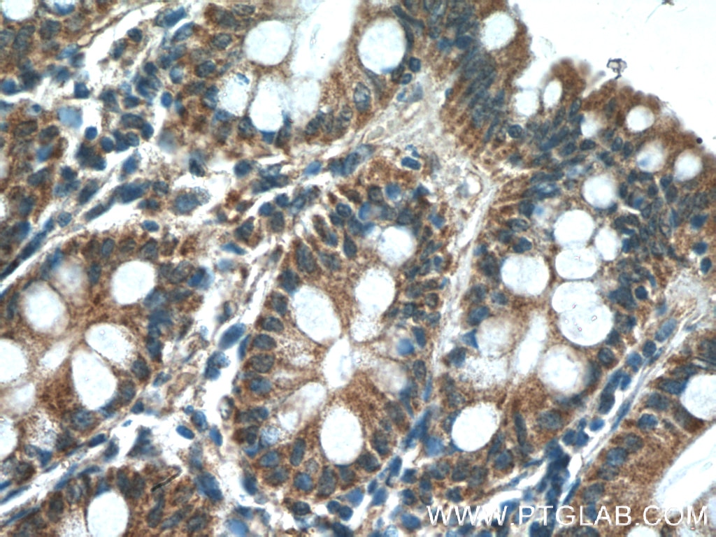 IHC staining of human colon using 10026-1-AP