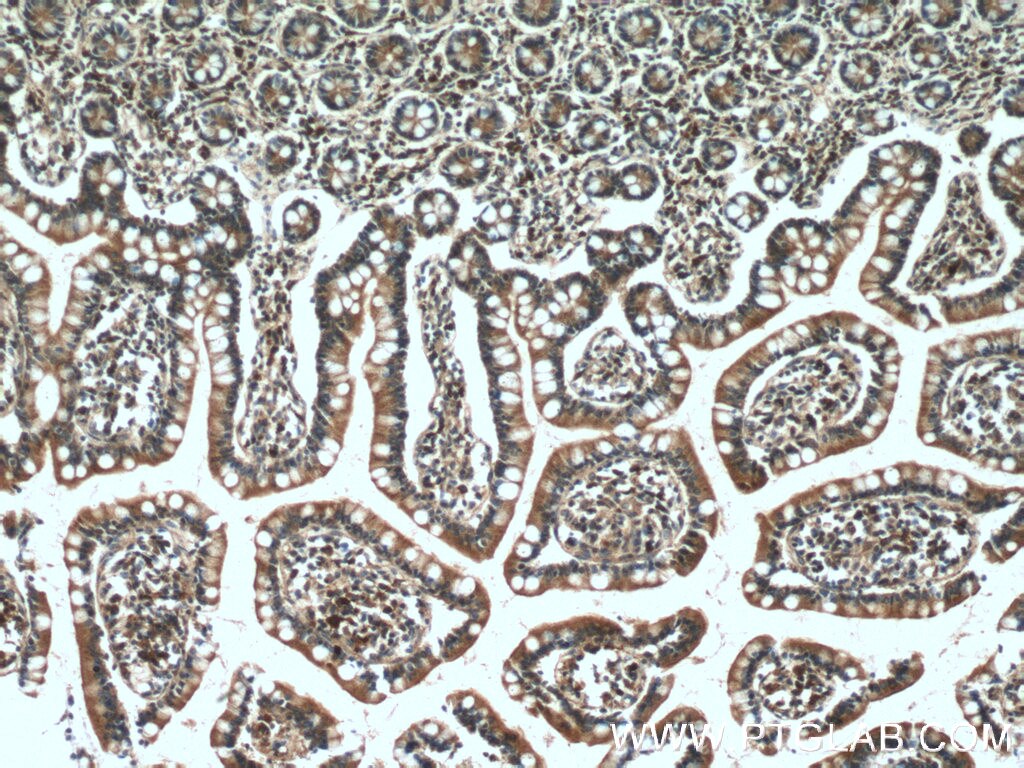 Immunohistochemistry (IHC) staining of human small intestine tissue using PDK1 Polyclonal antibody (10026-1-AP)