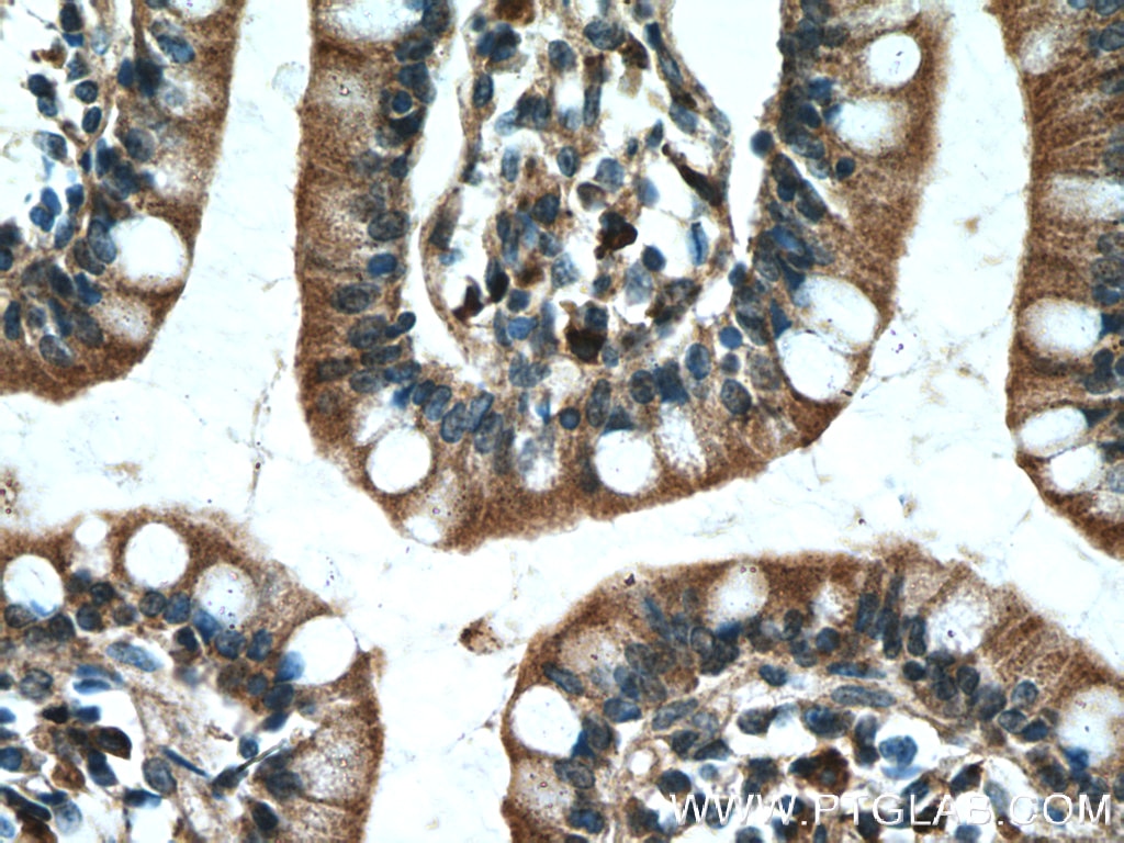 Immunohistochemistry (IHC) staining of human small intestine tissue using PDK1 Polyclonal antibody (10026-1-AP)