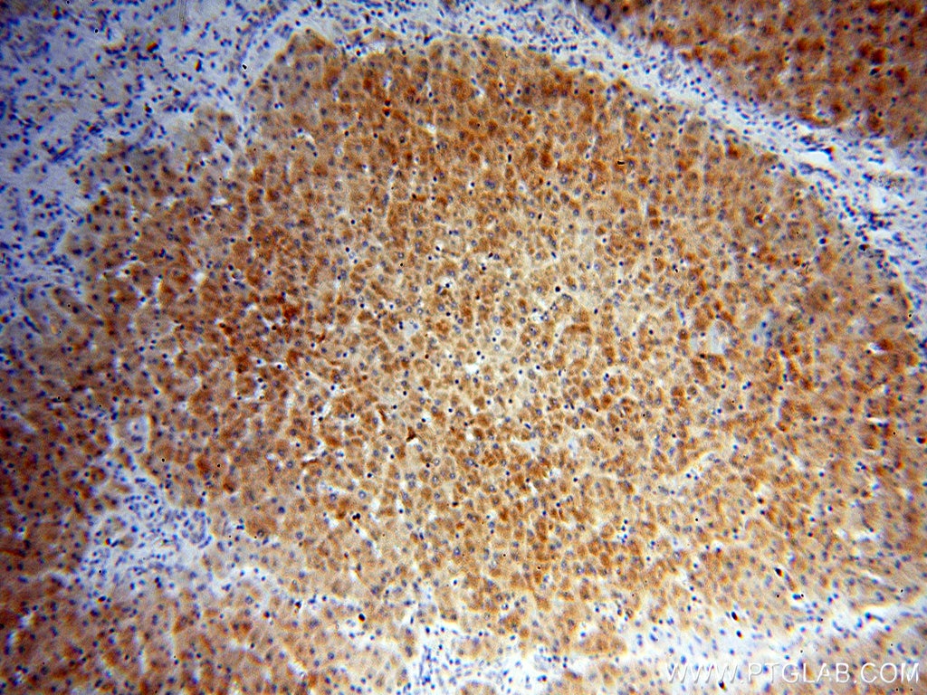 Immunohistochemistry (IHC) staining of human liver tissue using PDK1 Polyclonal antibody (10026-1-AP)