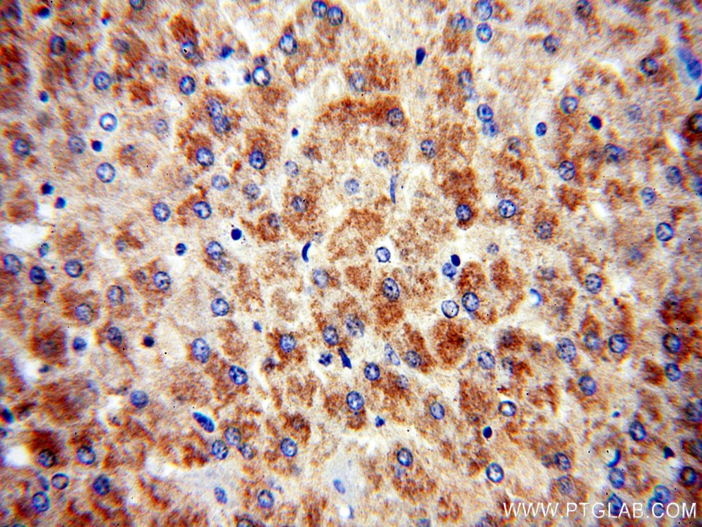 Immunohistochemistry (IHC) staining of human liver tissue using PDK1 Polyclonal antibody (10026-1-AP)