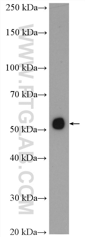 Western Blot (WB) analysis of mouse small intestine tissue using PDK1 Polyclonal antibody (10026-1-AP)